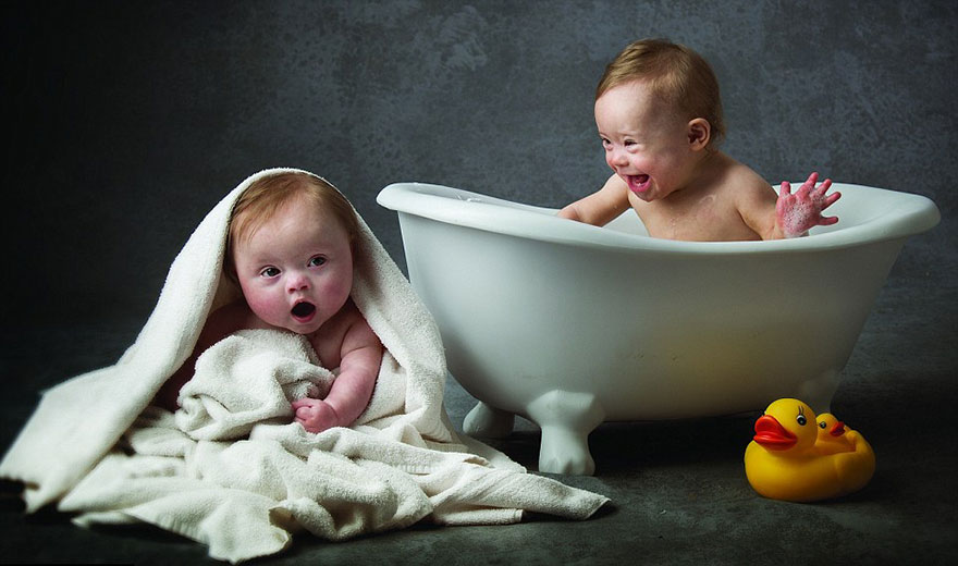 babies-downs-syndrome-awareness-charity-calendar-8