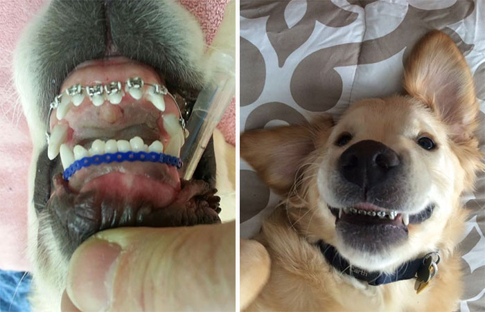 This Dog Couldn’t Close His Mouth, So He Got Braces