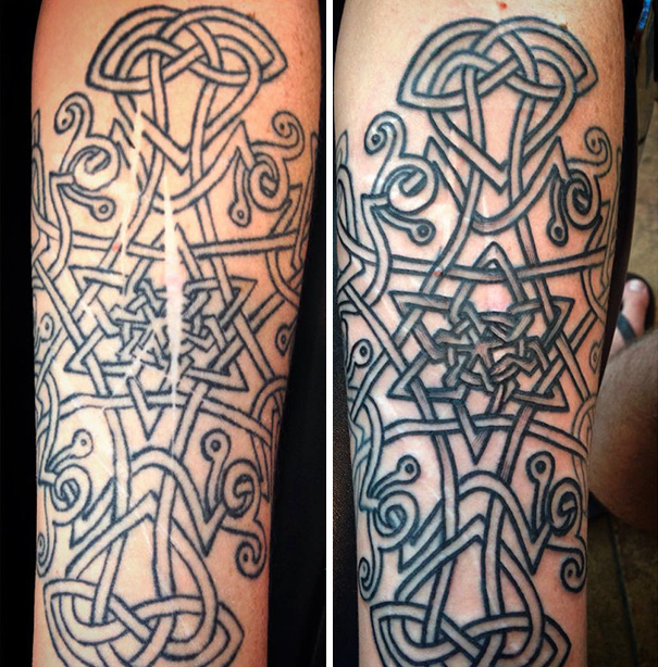 free-cover-up-tattoos-domestic-violence-self-harm-scars-brian-finn-5