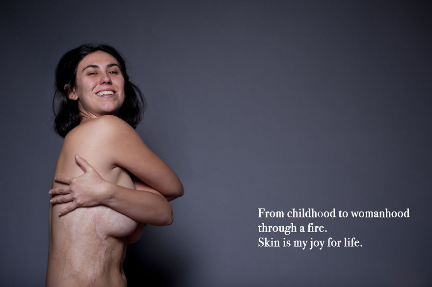 I Photographed Personal Portraits Showing The Different Ways To Live One's Own Skin