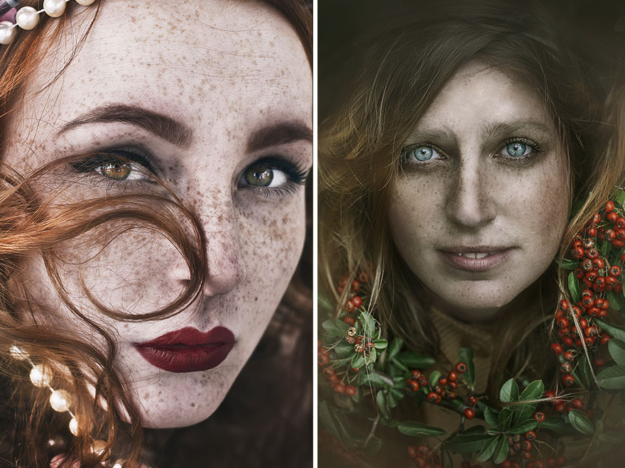 My Pictures Reveal The True Beauty Of Freckles