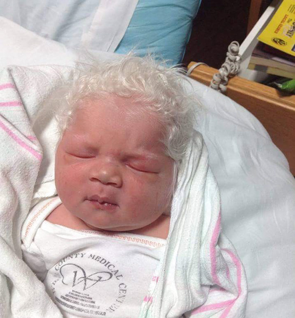 Baby With The Whitest Hair I've Ever Seen