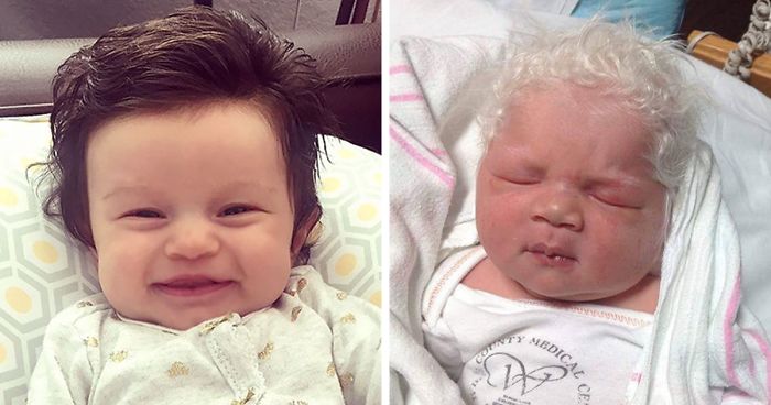 Parents Share Pics Of Babies Born With Full Heads Of Hair 425
