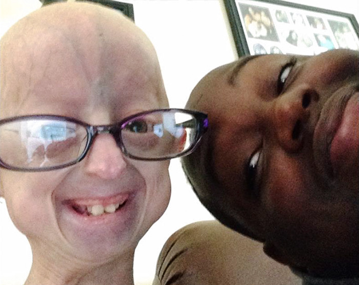 girl-rare-disease-progeria-powerlifter-friendship-lindsay-ratcliffe-david-douglas-21