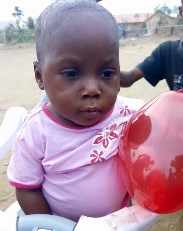 2-Year-Old 'Witch Child' Who Was Left To Die Makes Stunning Recovery