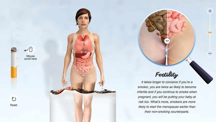 World No Tobacco Day - Graphic Reveals The True Horrors Of Smoking