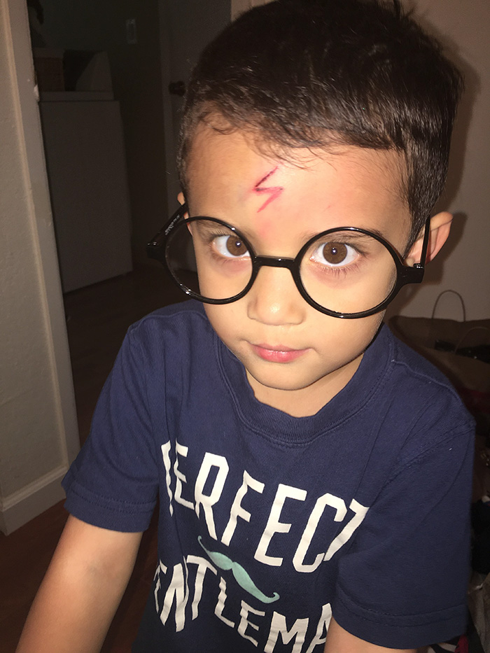 Mom Turns Crying Kid's Cut Into Harry Potter Lighting Bolt, Makes Him Happy Again