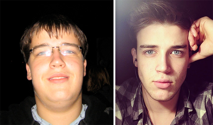 The Difference A 70 Lbs Weight Loss Makes On Your Face