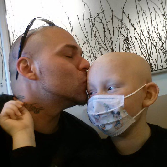 Dad Tattoos His Son's Cancer Scar On His Own Head To Boost Son's Self-Confidence