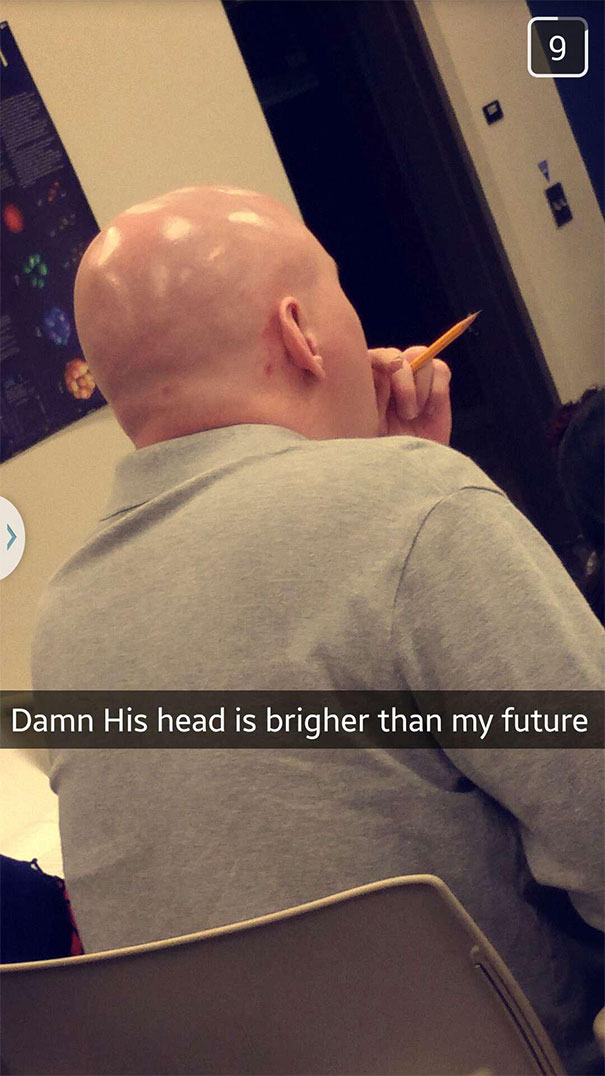 Damn His Head Is Brighter Than My Future