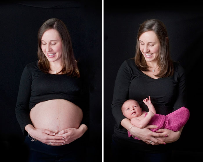 15+ Before & After Pics Of Mothers Going Through The Most 