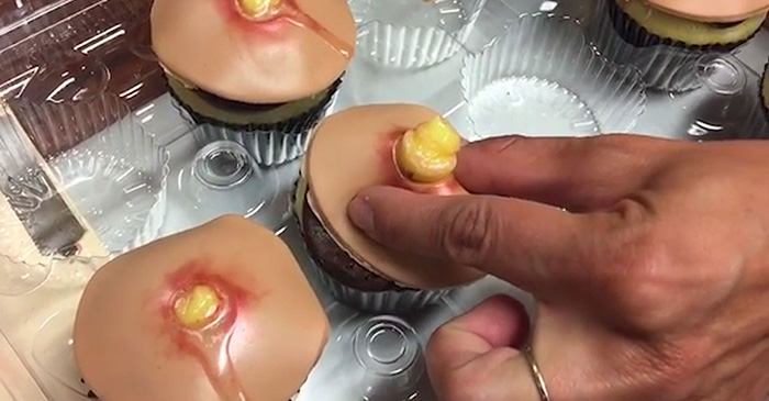 pimple-cupcakes-dr-pimple-popper-blessed-by-baking-4