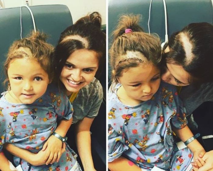 Mom Shaves Her Head To Help Her Little Girl Cope With Brain Surgery