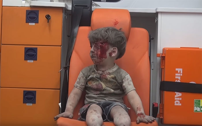Heartbreaking Photo Of Dazed 5-Year-Old Boy Shows The Horrors Of Syria's Civil War