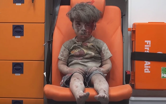 Heartbreaking Photo Of Dazed 5-Year-Old Boy Shows The Horrors Of Syria’s Civil War