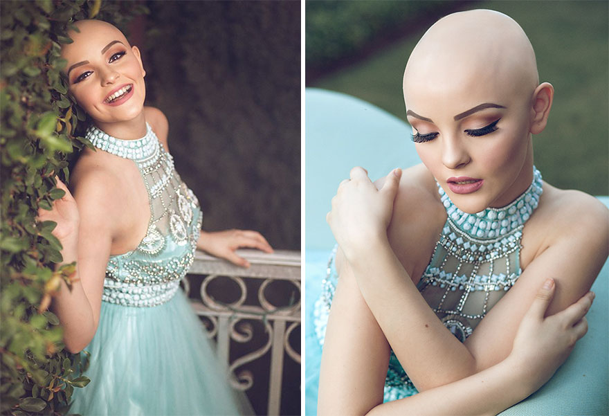 17-Year-Old With Cancer Just Made A Very Powerful Statement After Losing Her Hair