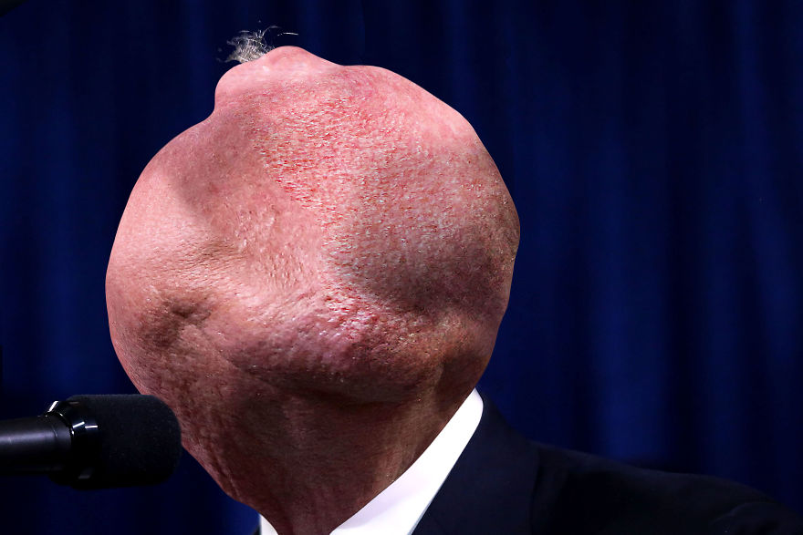 I Lost Sleep Thanks To Mutant Donald Trump I Lost Sleep Thanks To Mutant Donald Trump
