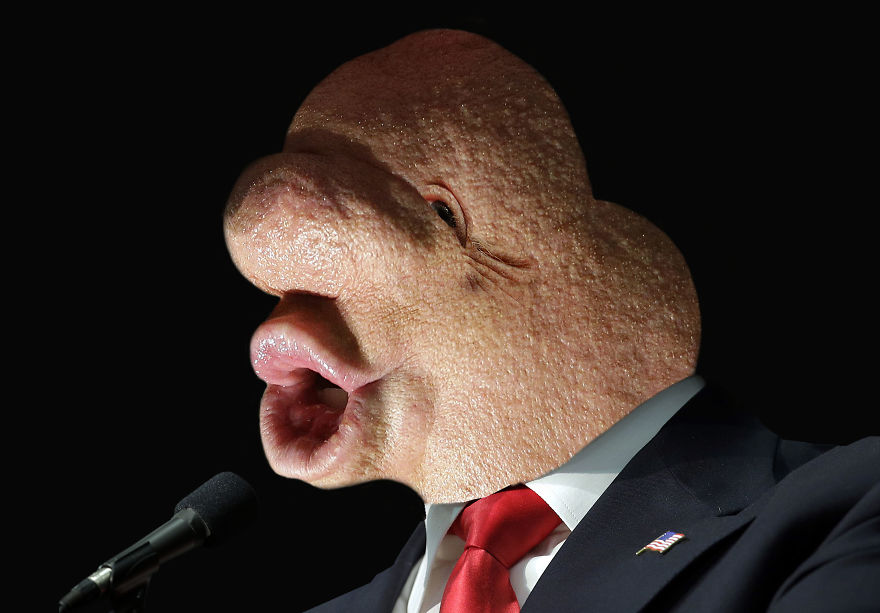 I Lost Sleep Thanks To Mutant Donald Trump I Lost Sleep Thanks To Mutant Donald Trump