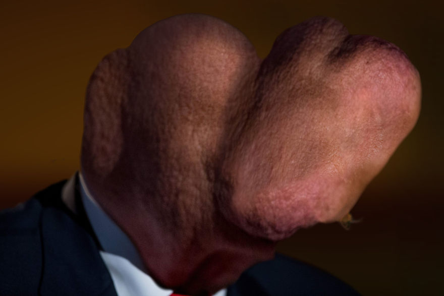I Lost Sleep Thanks To Mutant Donald Trump I Lost Sleep Thanks To Mutant Donald Trump