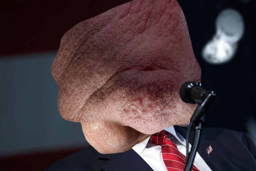 I Lost Sleep Thanks To Mutant Donald Trump I Lost Sleep Thanks To Mutant Donald Trump