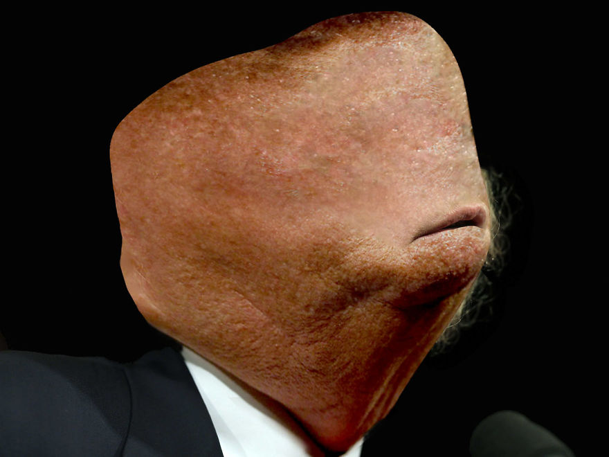 I Lost Sleep Thanks To Mutant Donald Trump I Lost Sleep Thanks To Mutant Donald Trump