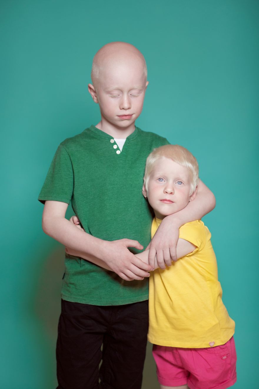 We Took Photographs Of Albino Kids To Show Their Pure Beauty