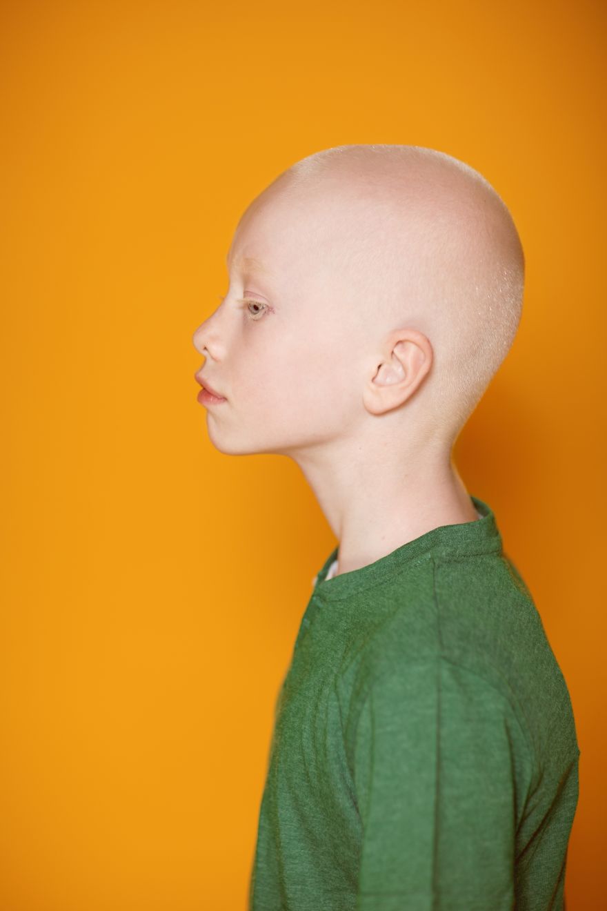 We Took Photographs Of Albino Kids To Show Their Pure Beauty