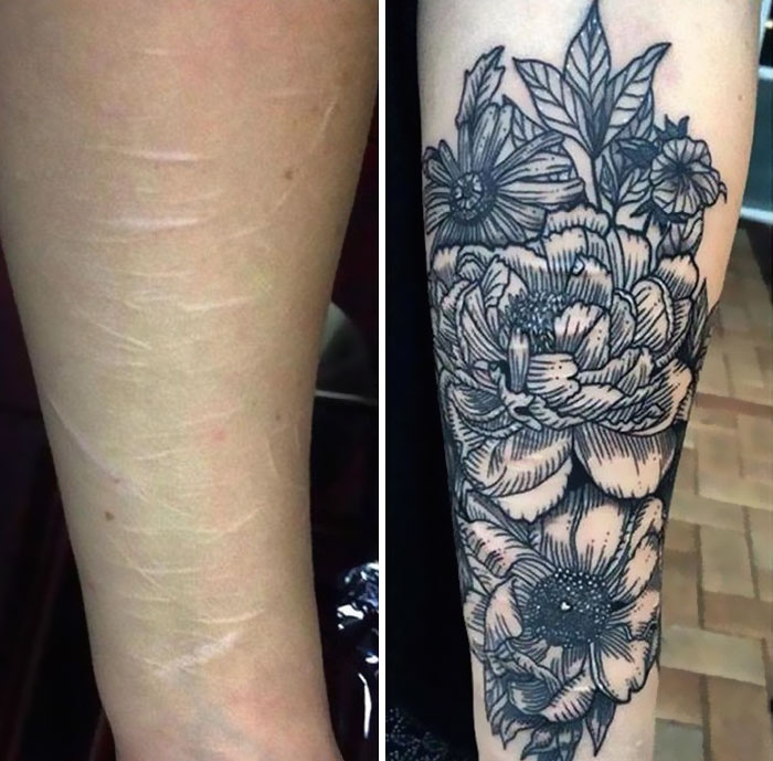 Flowers Covering Self-Harm Scars