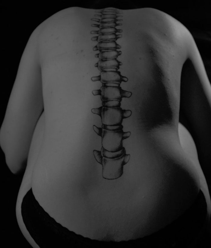 A Straight Spine In Celebration Of Overcoming Scoliosis