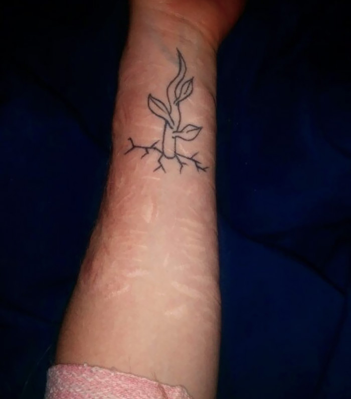 Tattoo Covering Two Scars From Self-Harm