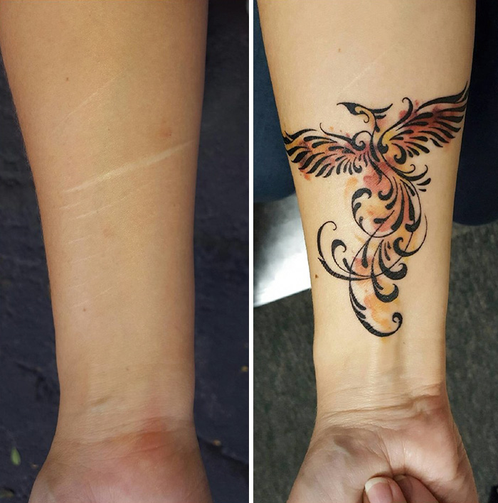 34 Scar-Covering Tattoos With Amazing Stories Behind Them | Bored Panda