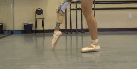 15-Year-Old Amputee Ballerina Who Lost Her Leg To Cancer, Makes An Unbelievable Recovery