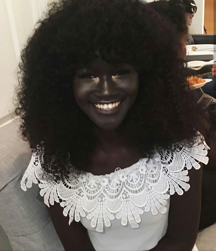 Teen Bullied For Her Incredibly Dark Skin Color Becomes A Model, Takes The Internet By Storm