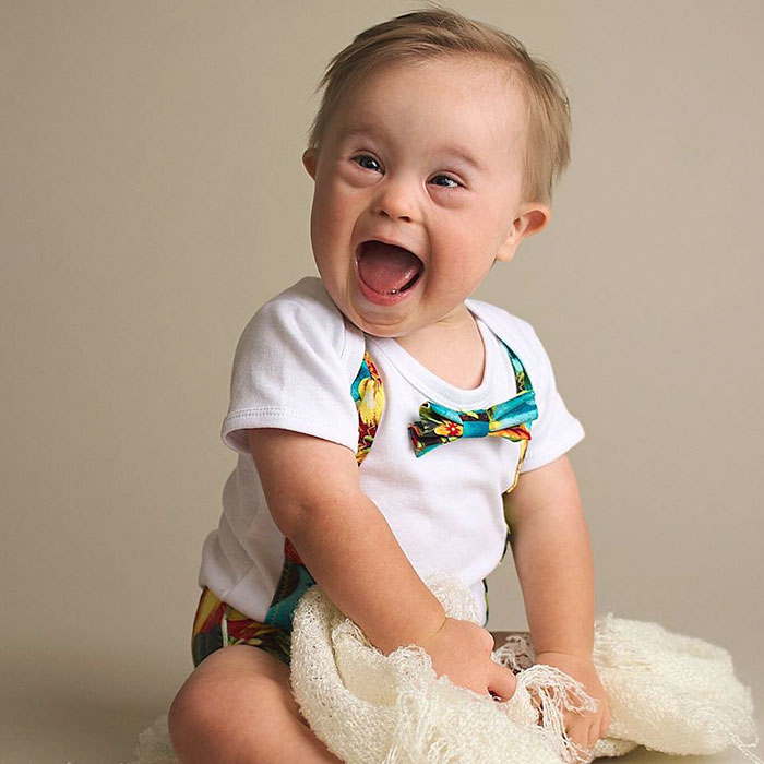 Kid Gets Rejected From Ad Campaign "Because He Has Down's Syndrome", Mom Fights Back