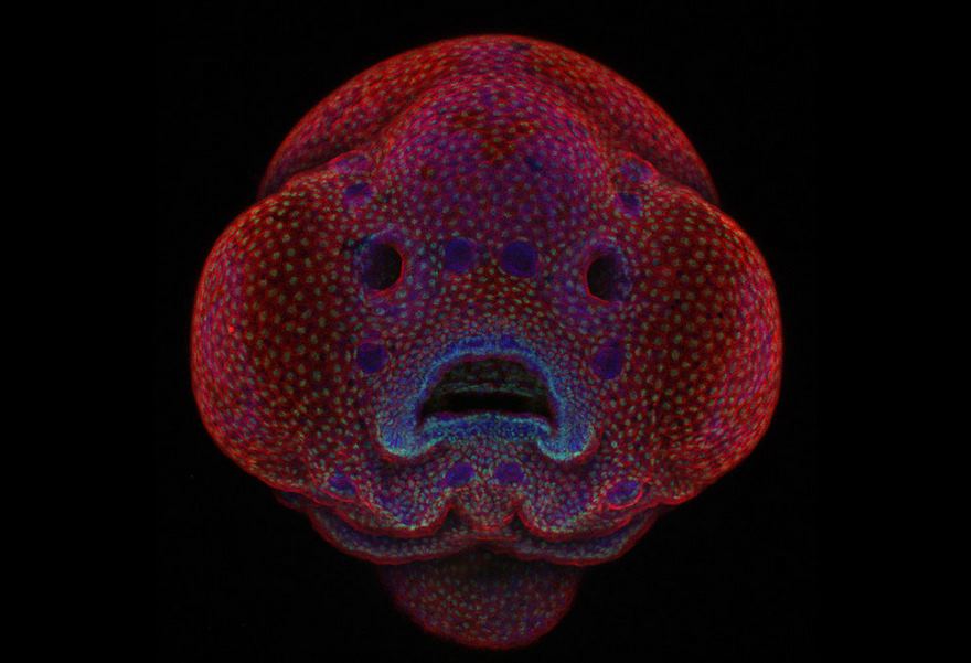 First Place. Four-Day-Old Zebrafish Embryo
