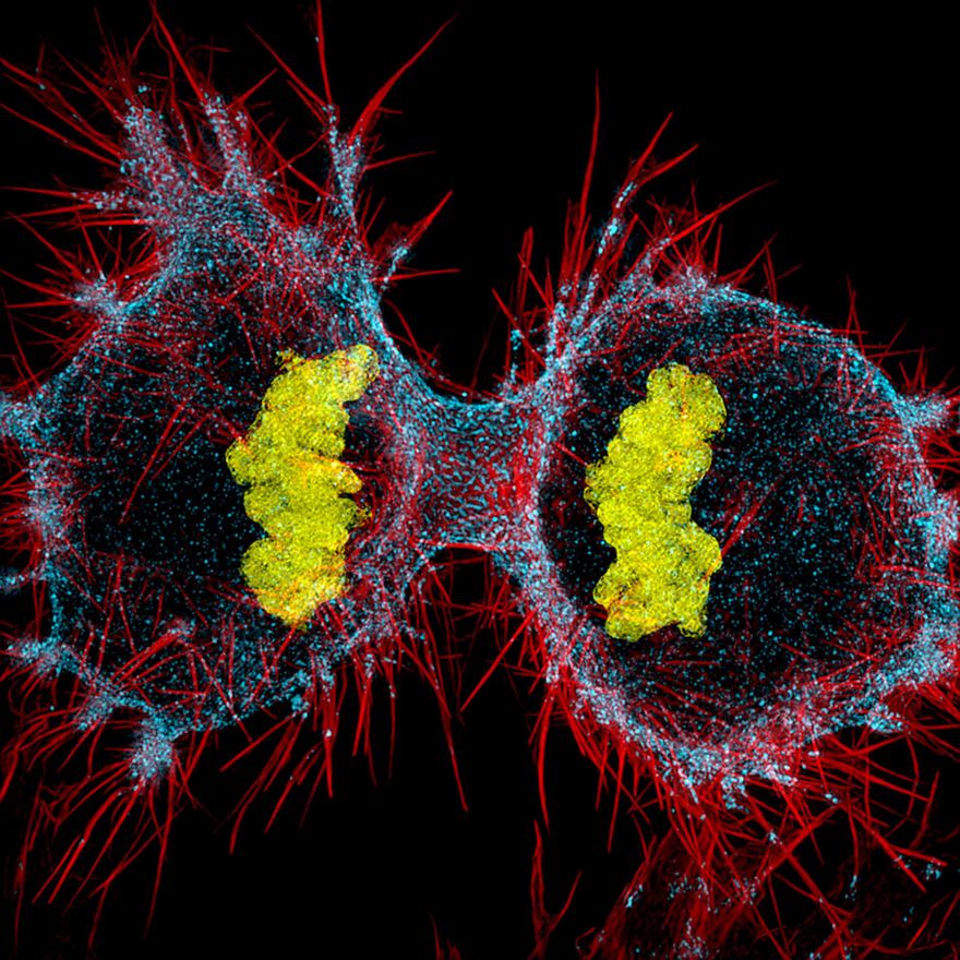 Twelfth Place. Human Hela Cell Undergoing Cell Division