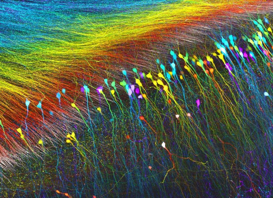 Hippocampal Neurons