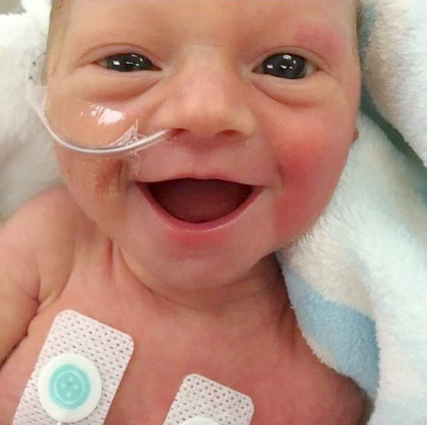Premature Baby Smiles From Ear To Ear 5 Days After Being Born