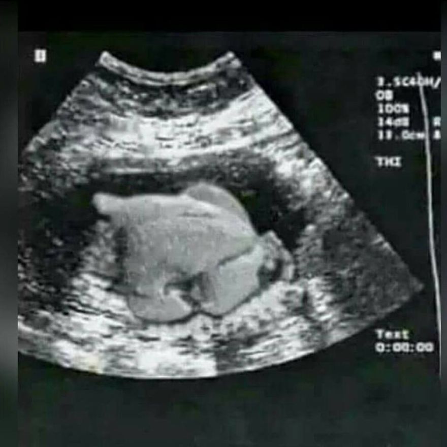 Expecting In Two Weeks