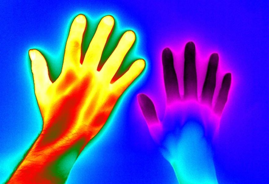 The Colourful Hands That Reveal Poor Circulation In Some People