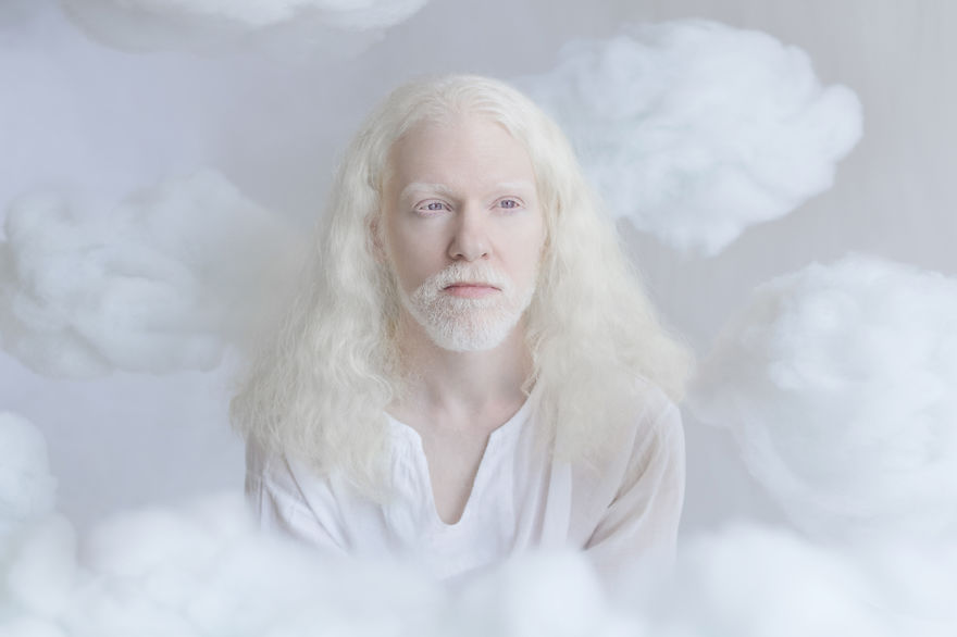 IMG 0173 s 582c43013b4fc  880 - A beleza dos albinos