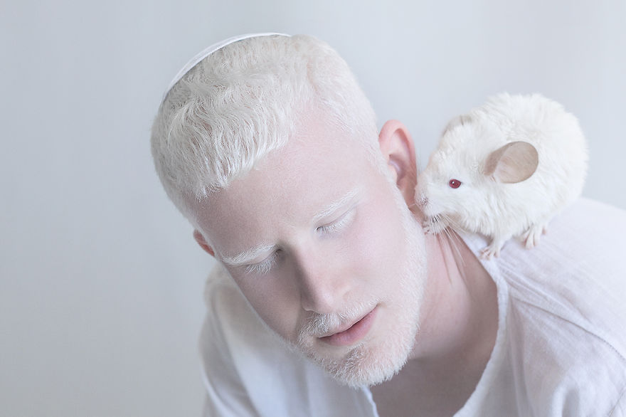 IMG 0404 s 582c430b6ce4a  880 - A beleza dos albinos