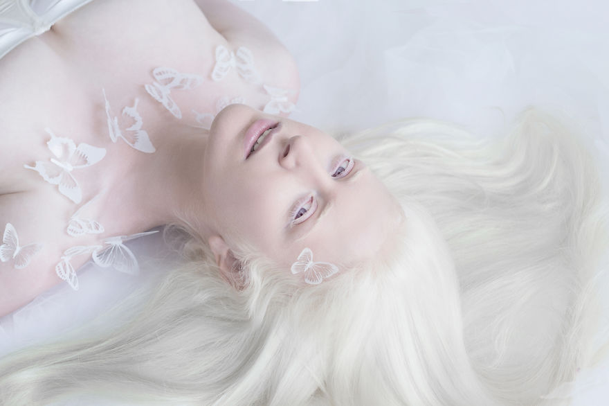 IMG 0551 s 582c43160c640  880 - A beleza dos albinos