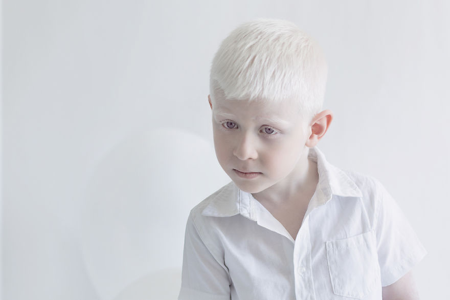 I Captured The Hypnotizing Beauty Of Albino People