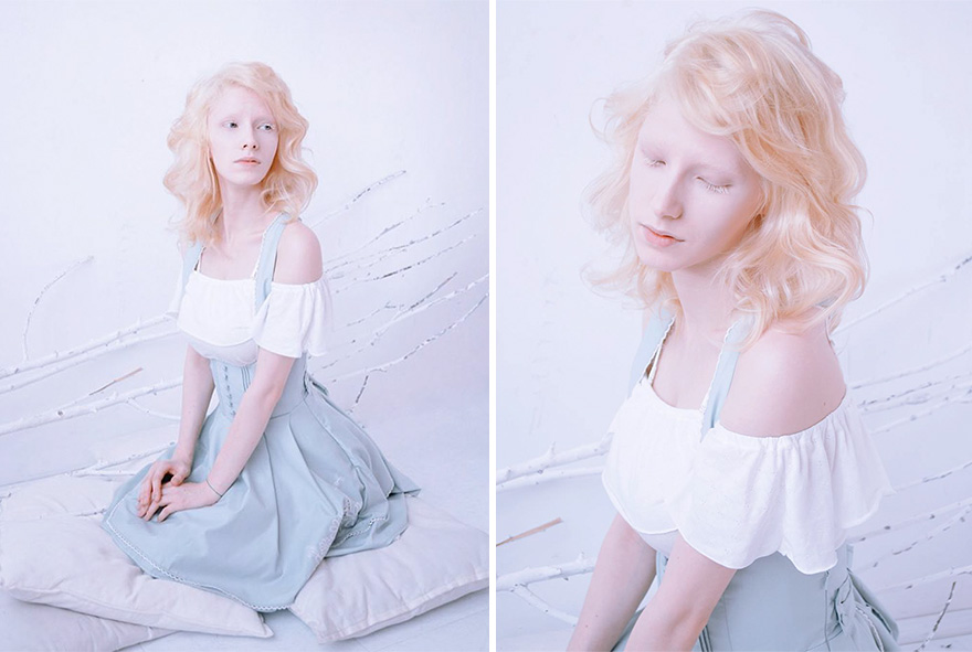 Albino Girl Bonn