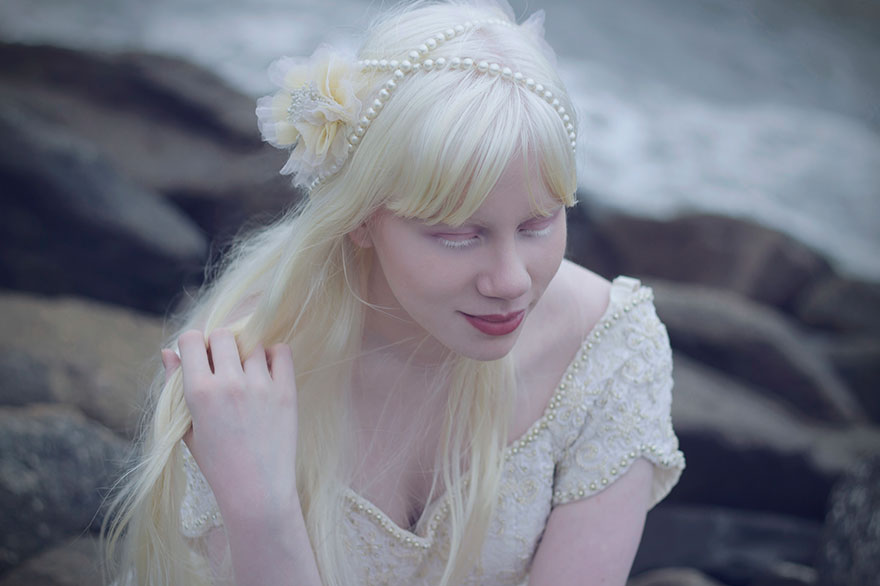Albino Girl By The Sea