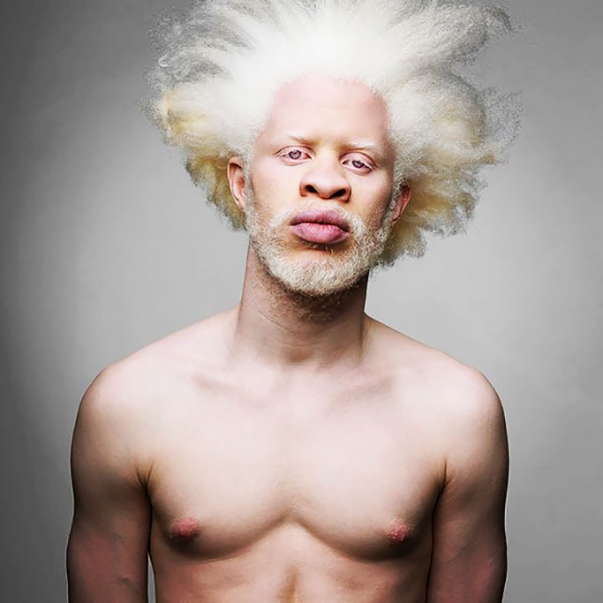 58 Albino People Who'll Mesmerize You With Their Beauty | Bored Panda