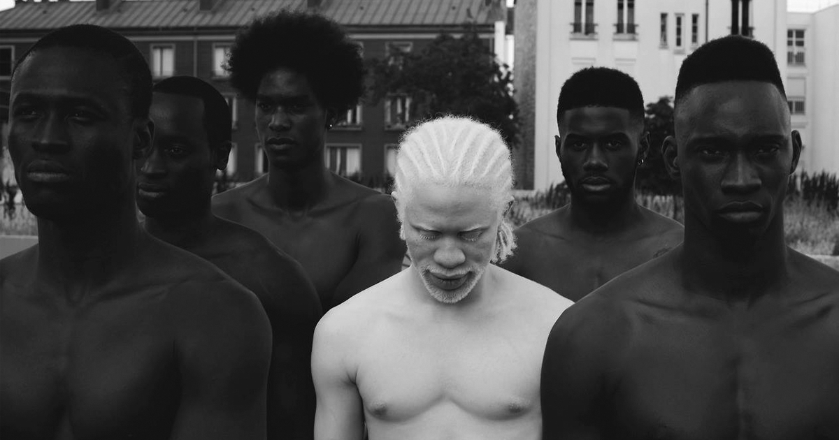 58 Albino People Who’ll Mesmerize You With Their Otherworldly Beauty