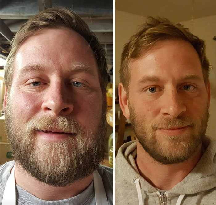 50 Before-And-After Pics Show What Happens When You Stop Drinking