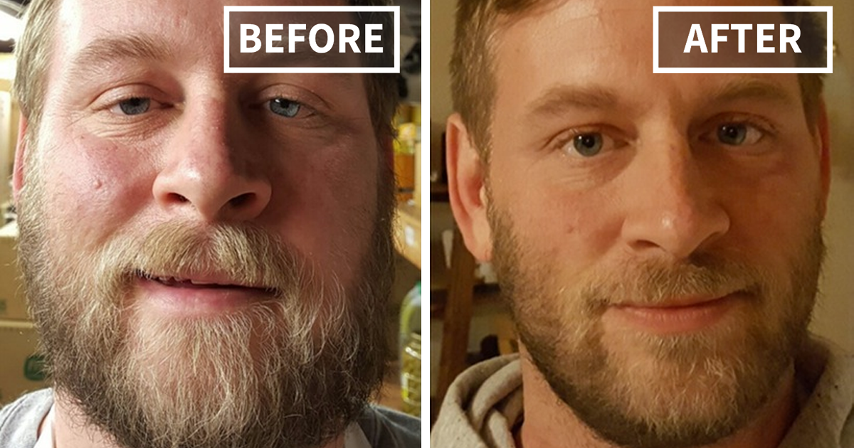 50 Before-And-After Pics Show What Happens When You Stop Drinking